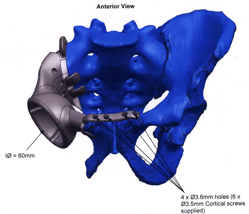 Fig 5. Technical drawing anterior